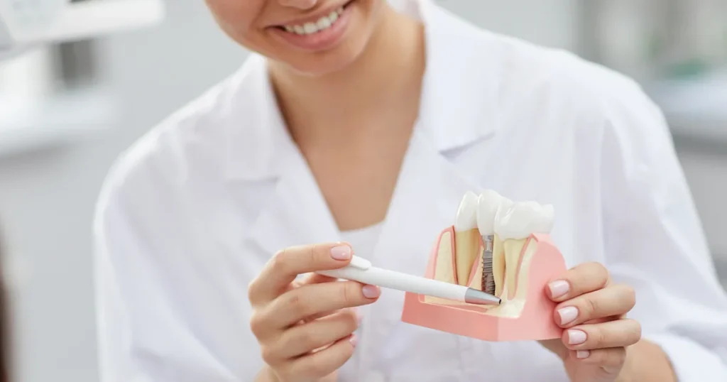 En kvinde holder stolt en model af et tandimplantat.